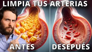 Haz Esto para Destapar tus Arterias y Corregir tu Colesterol