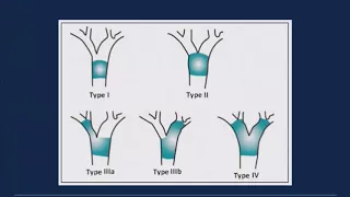 2018 Cholangiocarcinoma Foundation Annual Conference #8 - Day 1 - Management of Biliary Obstruction