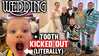 Lost His First Tooth at a Wedding, Then Actually LOST it!