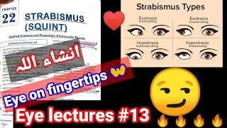 Eye lectures #13. #Strabismus. #Squient. exotropia entropia #hypertropia #hypotropia #eye