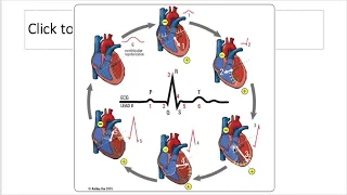 ECG Interpretation - Dr PJ Regan - NMSS/RMOA Lecture Series