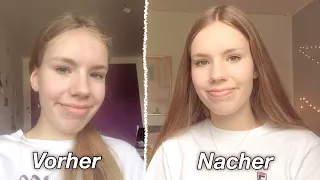 10 Tipps für reine Haut / gegen Pickel (Gesicht & Körper)