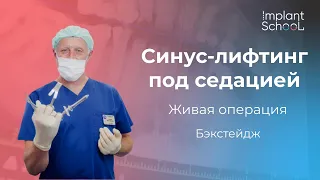 Синус-лифтинг в прямом эфире Живая операция. Бэкстейдж