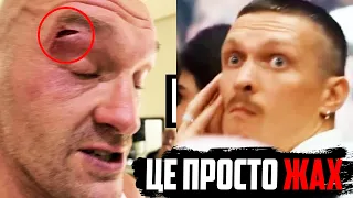 ❌БІЙ Усик vs Ф’юрі СКАСОВАНО! Ф’юрі отримав РОЗСІЧЕННЯ! Перший коментар британця!