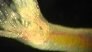 Phoronid worm