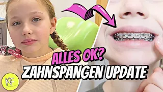 ZAHNSPANGEN-UPDATE 🦷 DM EINKAUF 🛍 XXL VLOG | KLEINE FAMILIENWELT