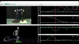 3D Motion Analysis of Sit To Stand Test