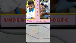 Tears under microscope #shorts #tears #viral #microscope