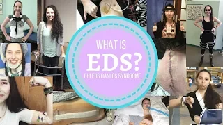 Living with EDS: What is Ehlers Danlos Syndrome?