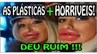 🔴 Plásticas Terríveis! As Plásticas dos famosos que deram errado! PARTE 1