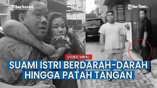 Gara-gara Bunyikan Klakson, Suami Istri ini Berdarah darah hingga Patah Tangan