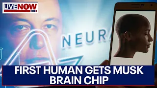 Elon Musk: Neuralink brain implant put in human patient for first time | LiveNOW from FOX