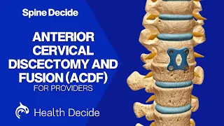Anterior Cervical Discectomy and Fusion (ACDF) - 3D Animation (No Narration)