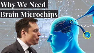 Why Brain Chips are a Good Idea.