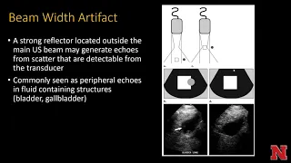 UltrasoundBioaffectsAndArtifacts