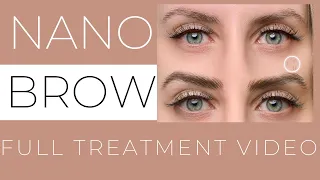 Nano Brow Full Treatment Start to Finish