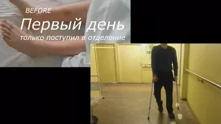 Успех Реабилитации | Травма позвоночника и спинного мозга | Lumbar Spine Fractures