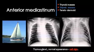 Mediastinum Suhag  12 25 2014 7 28 55 PM