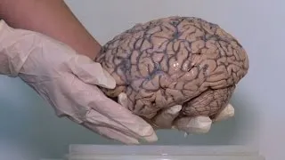 Belgium gets world's biggest pickled brain collection