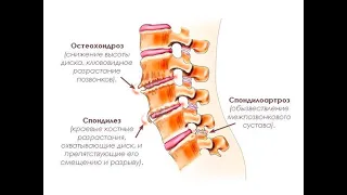 Запись прямого эфира "Здоровая спина"