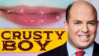 Brian Stelter: Crustiest Lips in America