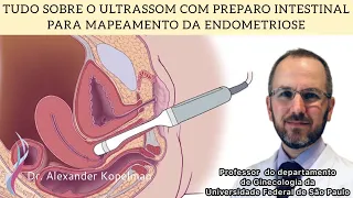 TUDO SOBRE O ULTRASSOM COM PREPARO INTESTINAL PARA MAPEAMENTO DA ENDOMETRIOSE