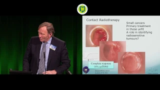 Neil Mortensen on "Saving the Sphincter - a Story of Surgical Evolution"