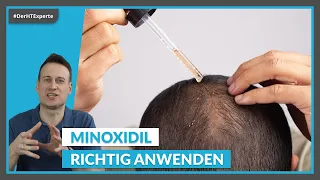 Minoxidil bei Haarausfall: Die RICHTIGE Dosierung, Nebenwirkungen & Kosten