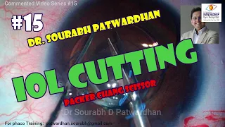 Commented 15 IOL cutting and exchange Dr Sourabh Patwardhan
