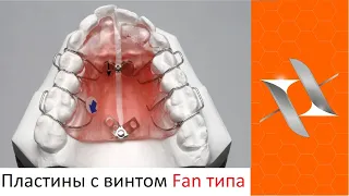 Ортодонтические пластинки с винтами для веерного расширения (Fan тип)