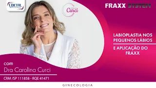 Labioplastia nos pequenos lábios e Aplicação do FRAXX com Dra Carolina Curci