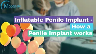 Inflatable Penile Implant | How A Penile Implant Works