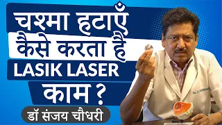 What is Lasik Laser & what are the options in Lasik Laser eye surgery (in Hindi) | Eye7, New Delhi