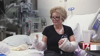 Woman who lost her hands, feet gets life-changing procedure from Duke University Hospital (Full)