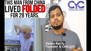 This Man in China Lived Folded For 28 Years | Vanya Raj |Choose Your Career