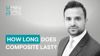 How long does composite bonding last?