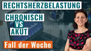 Rechtsherzbelastung: chronisch vs. akut - Fall der Woche