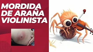 ¿Qué hacer si nos muerde una araña violinista?