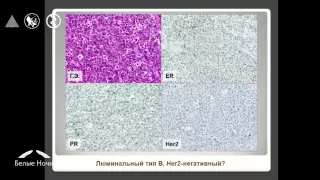 Предсказание чувствительности лекарственной терапии