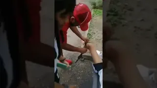 Adolescente herido por un jaguar  en Laón Guanjuato