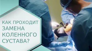 💁 Как проходит частичная замена коленного сустава? Замена коленного сустава как проходит операция.