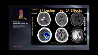 Differential diagnosis in Neuroimaging