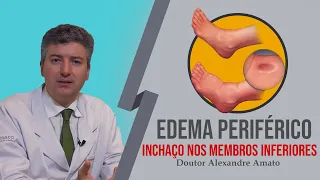 Inchaço nas pernas: Edema periférico