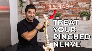 Pinched Nerve In Your Neck? Treat Your Cervical Radiculopathy