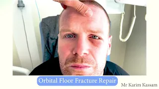 Trauma Management- Orbital Floor Fracture Repair || Mr Karim Kassam