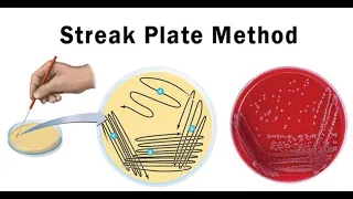 Lab technique microbiology: Streak plate method