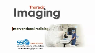 11 Thoracic Interventional radiology - prof.Mamdouh Mahfouz (2019 edition)