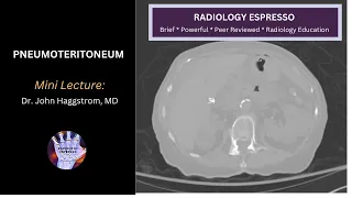 PNEUMOPERITONEUM: Mini Lecture, Dr. John Haggstrom, MD