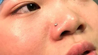 #Nostrilpiercing# #鼻钉# 穿孔过程 #成都穿孔# #成都穿刺#