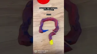 Identify the surgical procedure? | Dr. Rohan Khandelwal | Ruhani play-dough fun